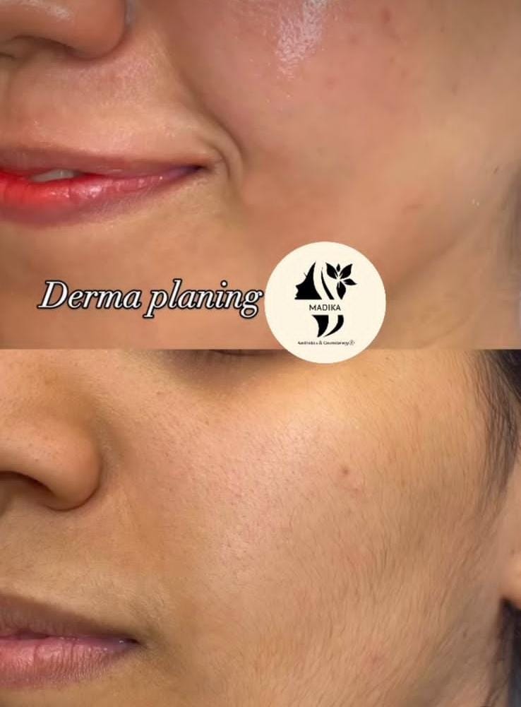 Before and after treatment comparison